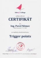 Trigger points
